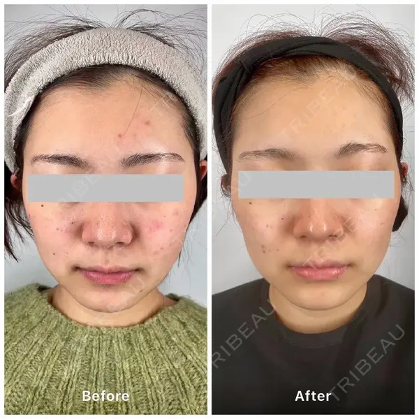 oneUPclinicの症例