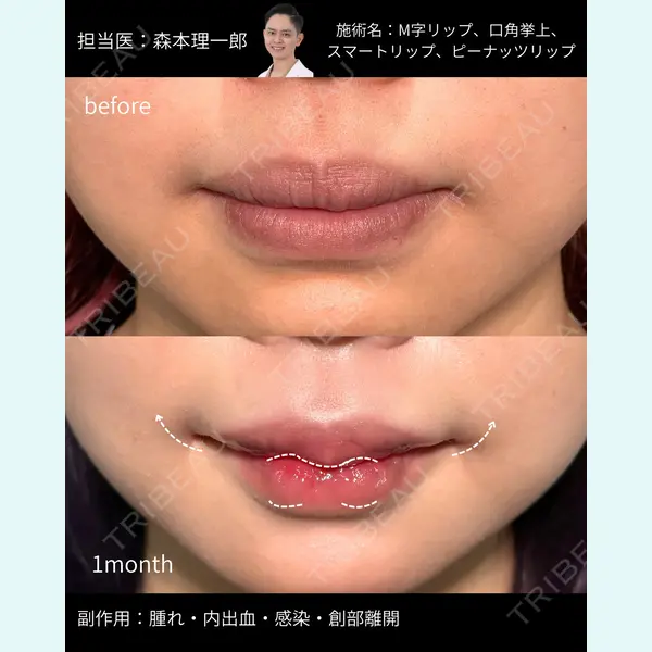 PRISM Beauty Clinic 町田院 森本 理一郎医師の症例