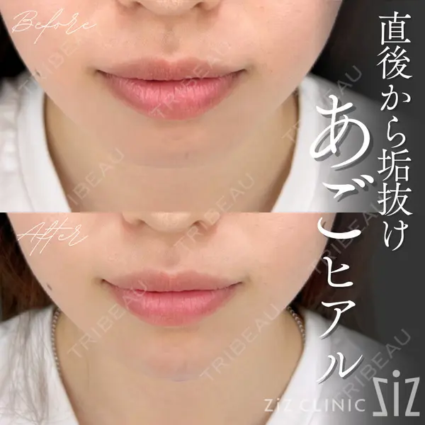 ziz CLINIC 村岡 史子医師の症例