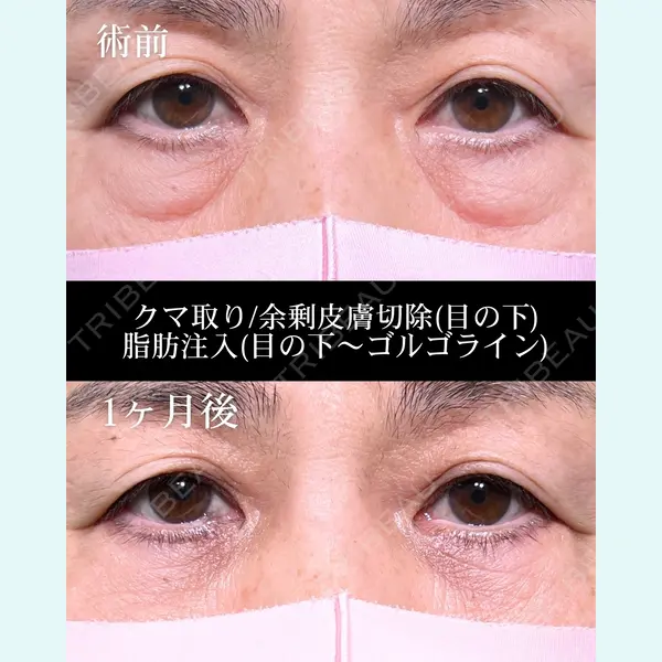 HAAB×DREAM BEAUTY CLINIC 大阪梅田院 鈴木 馨斗医師の症例