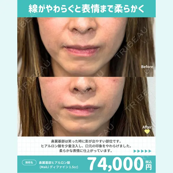 カジュアルクリニック 平塚院の症例