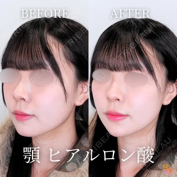 SK新宿歌舞伎町美容外科・歯科 岩本昌樹医師の症例