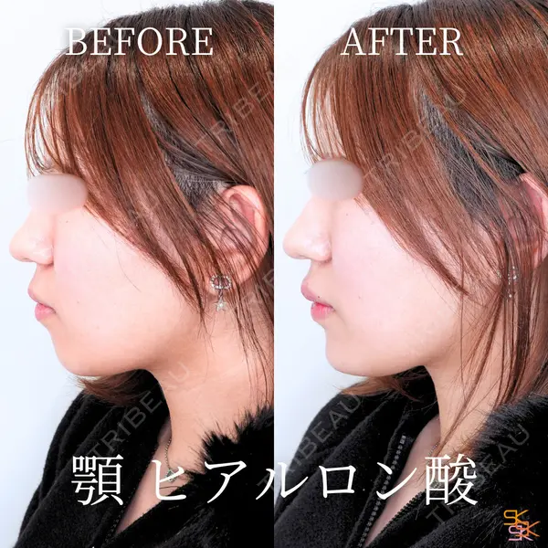 SK新宿歌舞伎町美容外科・歯科 岩本昌樹医師の症例