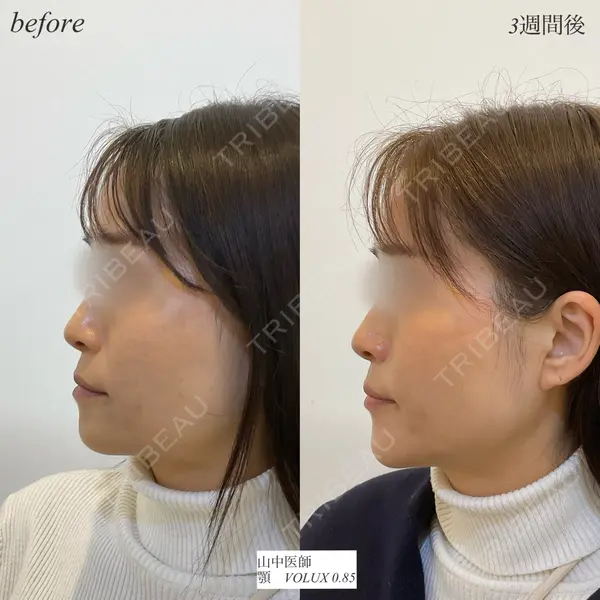 DMTC CLINIC 日本橋院 山中大介医師の症例