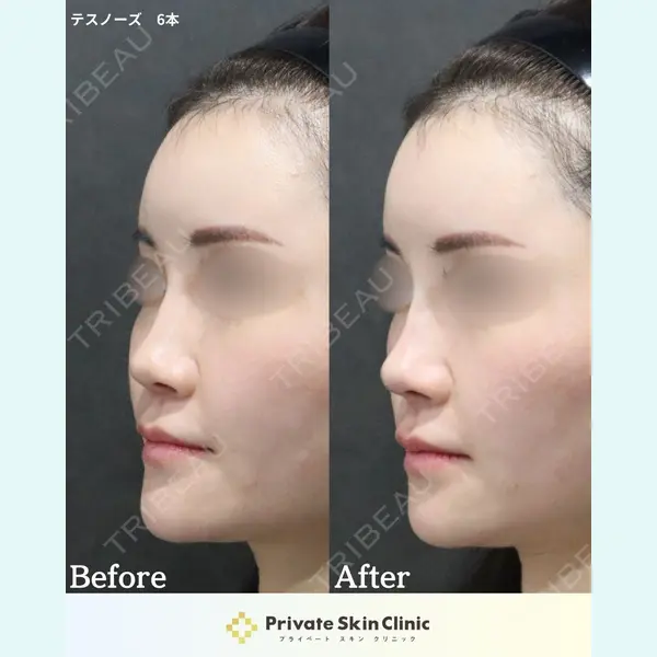 プライベートスキンクリニック 梅田本院 井畑 峰紀医師の症例