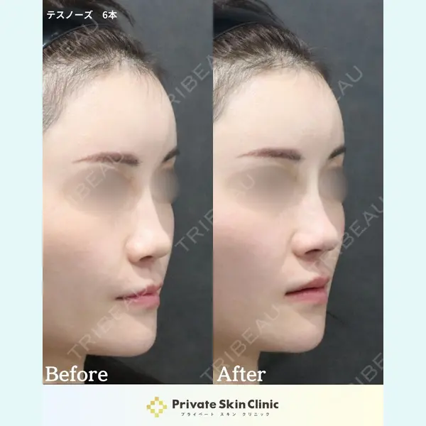 プライベートスキンクリニック 梅田本院 井畑 峰紀医師の症例