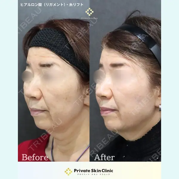 プライベートスキンクリニック 梅田本院 井畑 峰紀医師の症例