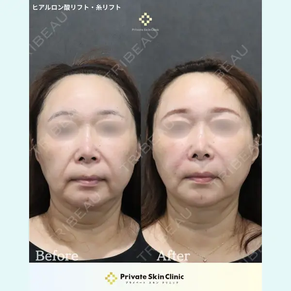 プライベートスキンクリニック 梅田本院 安形 省吾医師の症例