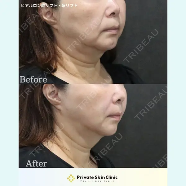 プライベートスキンクリニック 梅田本院 安形 省吾医師の症例