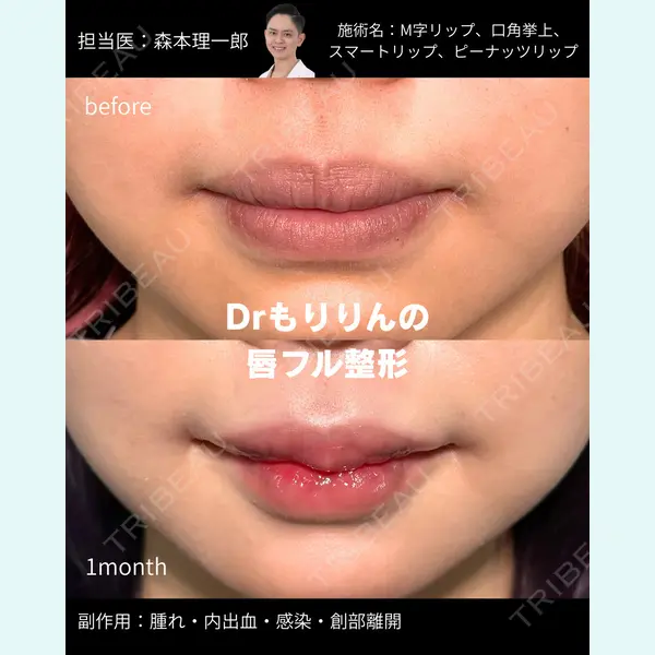 PRISM Beauty Clinic 町田院 森本 理一郎医師の症例