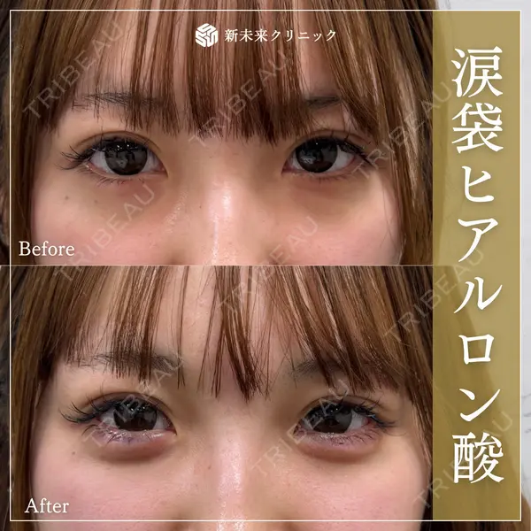 新未来クリニックの症例