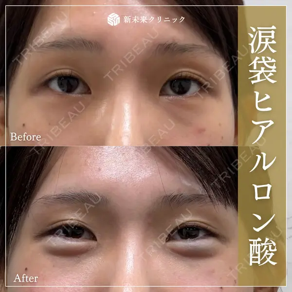 新未来クリニックの症例