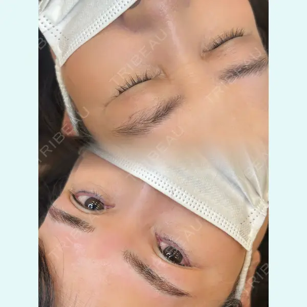 ブルームクリニック（BLOOM CLINIC） 武山 萌々佳医師の症例