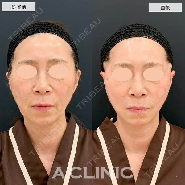 A CLINIC（エークリニック） 仙台院 伊藤 瑠桂医師の症例