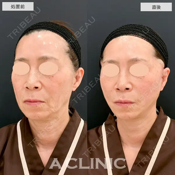 A CLINIC（エークリニック） 仙台院 伊藤 瑠桂医師の症例