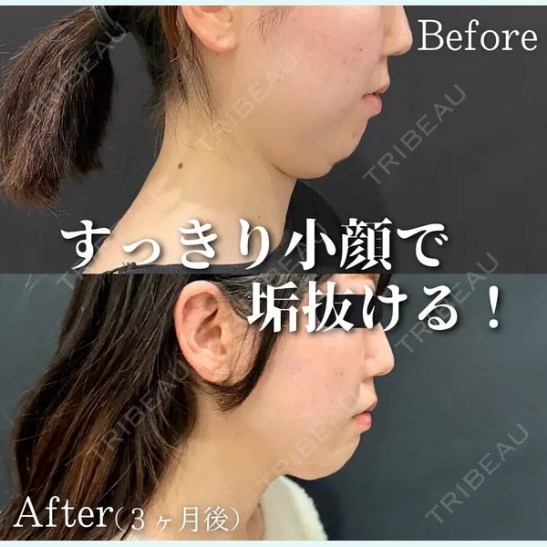 ブルームクリニック（BLOOM CLINIC） 大西 雅樹医師の症例