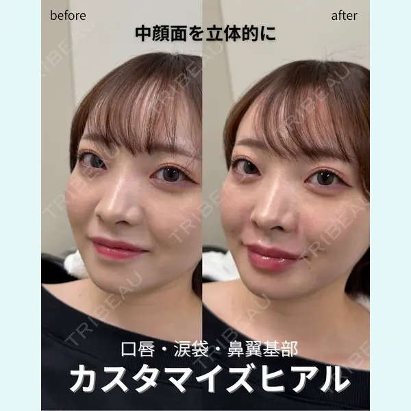 春山記念病院 山田 浩之医師の症例