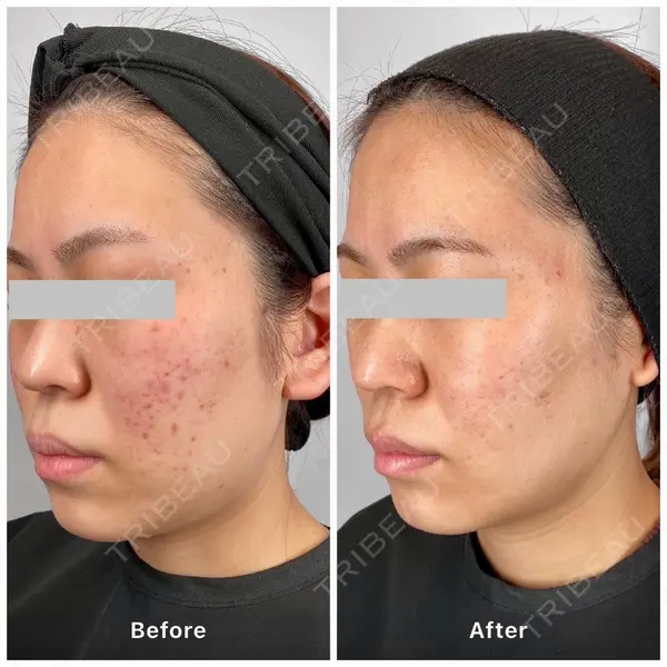 oneUPclinicの症例