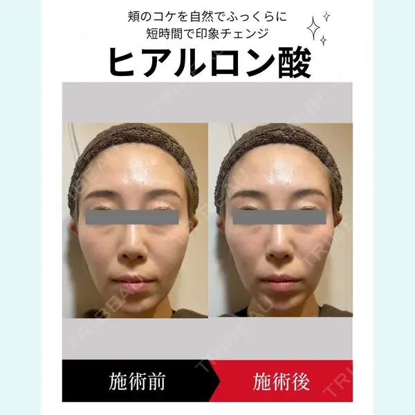 椿クリニック 名古屋院の症例