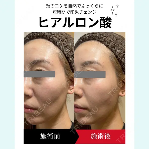 椿クリニック 名古屋院の症例