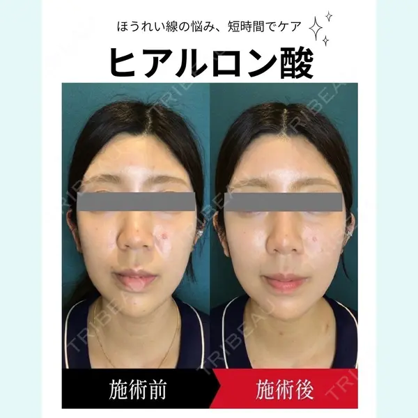 椿クリニック 名古屋院の症例