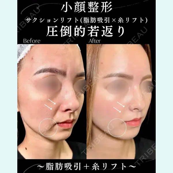 eクリニック 札幌院 岩井 勝矢医師の症例