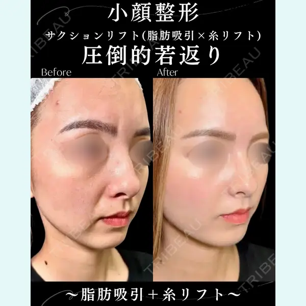 eクリニック 札幌院 岩井 勝矢医師の症例