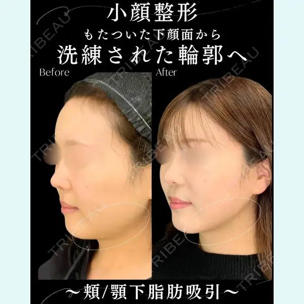 eクリニック 札幌院 岩井 勝矢医師の症例