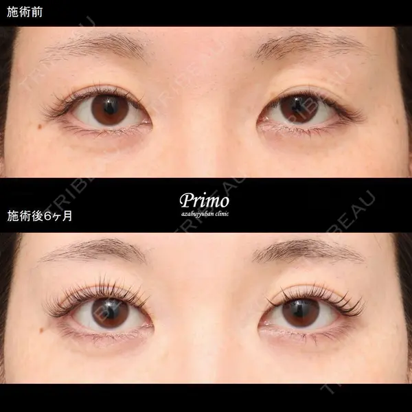 プリモ麻布十番クリニック 大場教弘医師の症例