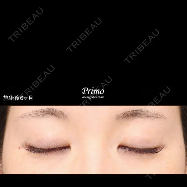 プリモ麻布十番クリニック 大場教弘医師の症例