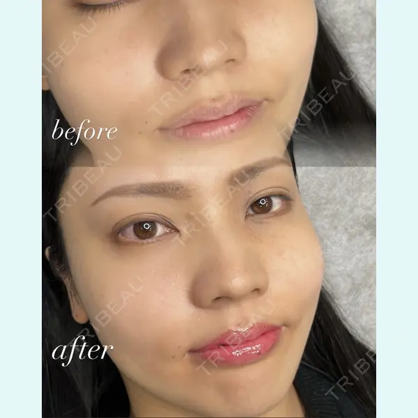 LEAGRANT CLINIC 中目黒の症例