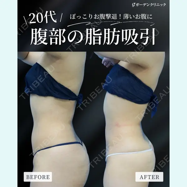 ガーデンクリニック 大阪院 松口 崇央医師の症例