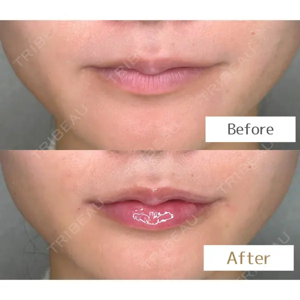 Belle Via Skin Clinic 宮田 知里医師の症例