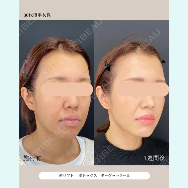 自由が丘ウェルエイジングビューティークリニック 福田 知佐子医師の症例