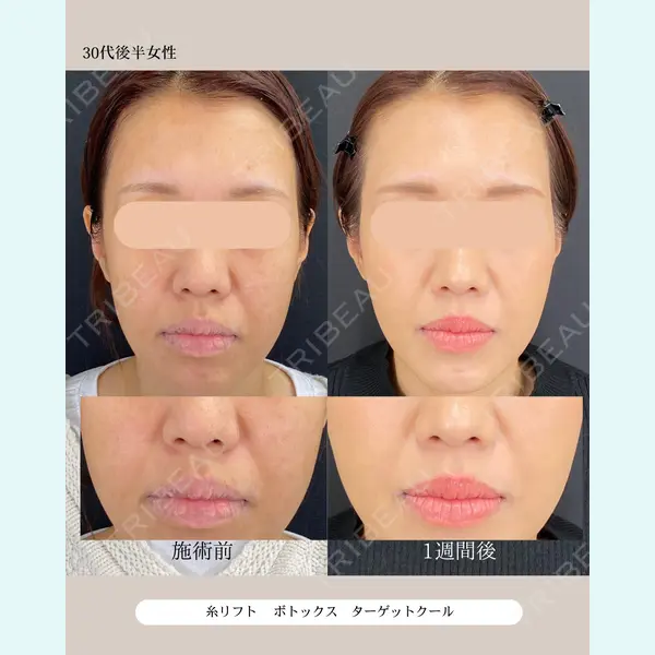 自由が丘ウェルエイジングビューティークリニック 福田 知佐子医師の症例