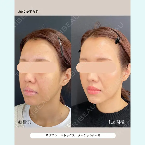 自由が丘ウェルエイジングビューティークリニック 福田 知佐子医師の症例