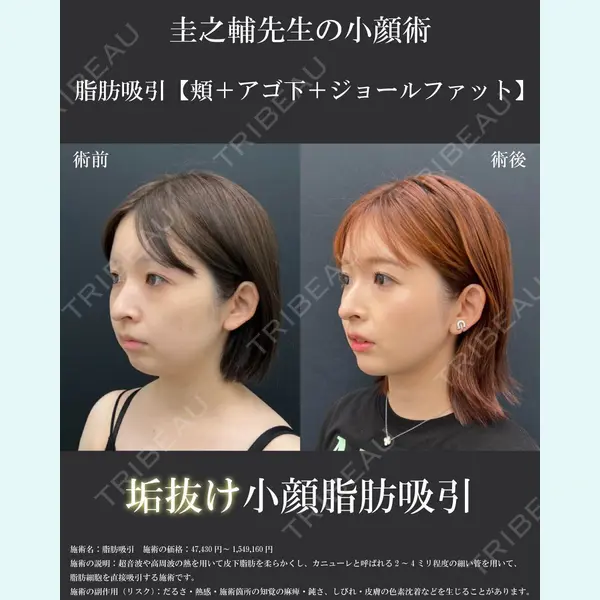 湘南美容クリニック 川崎院 佐藤 圭之輔医師の症例