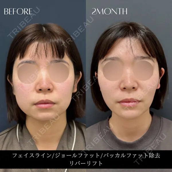 RIVER CLINIC（リバークリニック）の症例