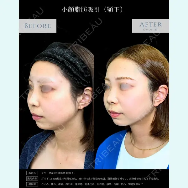 eクリニック 富山駅前院 相原 隆充医師の症例