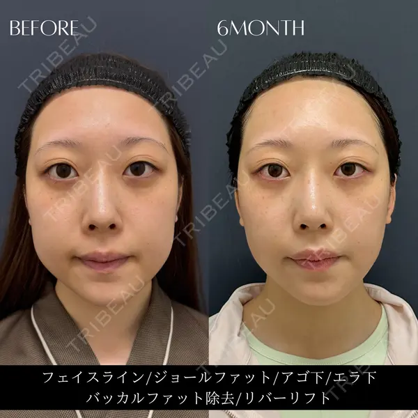 RIVER CLINIC（リバークリニック）の症例