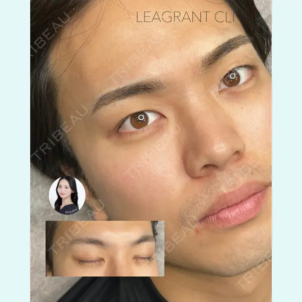 LEAGRANT CLINIC 中目黒の症例
