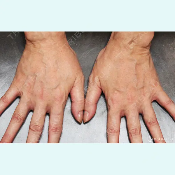 聖心美容クリニック 札幌院 前多 一彦医師の症例