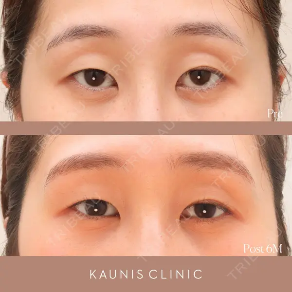 KAUNIS CLINIC（カウニスクリニック）の症例