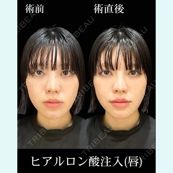 HAAB×DREAM BEAUTY CLINIC 東京本院 佐野 圭医師の症例