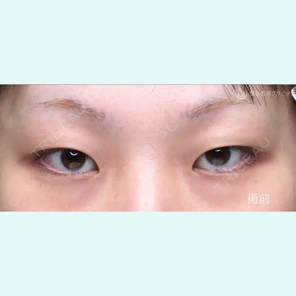 聖心美容クリニック 銀座院 川端 優也医師の症例