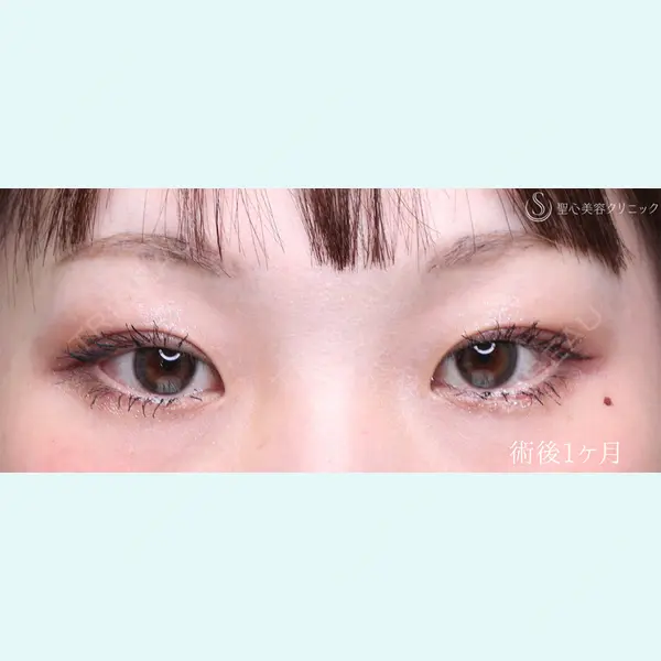 聖心美容クリニック 銀座院 川端 優也医師の症例