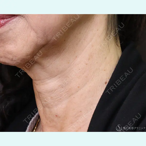 聖心美容クリニック 横浜院 佐々木 直美医師の症例