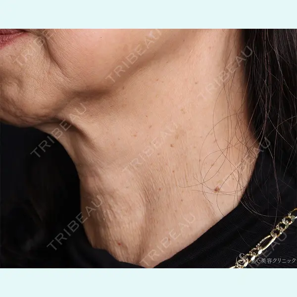 聖心美容クリニック 横浜院 佐々木 直美医師の症例