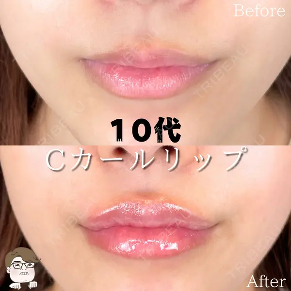 ルラ美容クリニック 札幌本院 佐藤 雄紀医師の症例