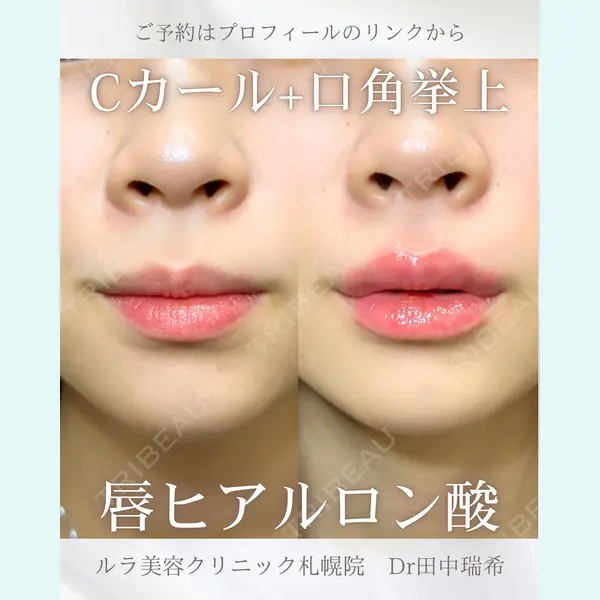 ルラ美容クリニック 札幌本院 田中 瑞希医師の症例